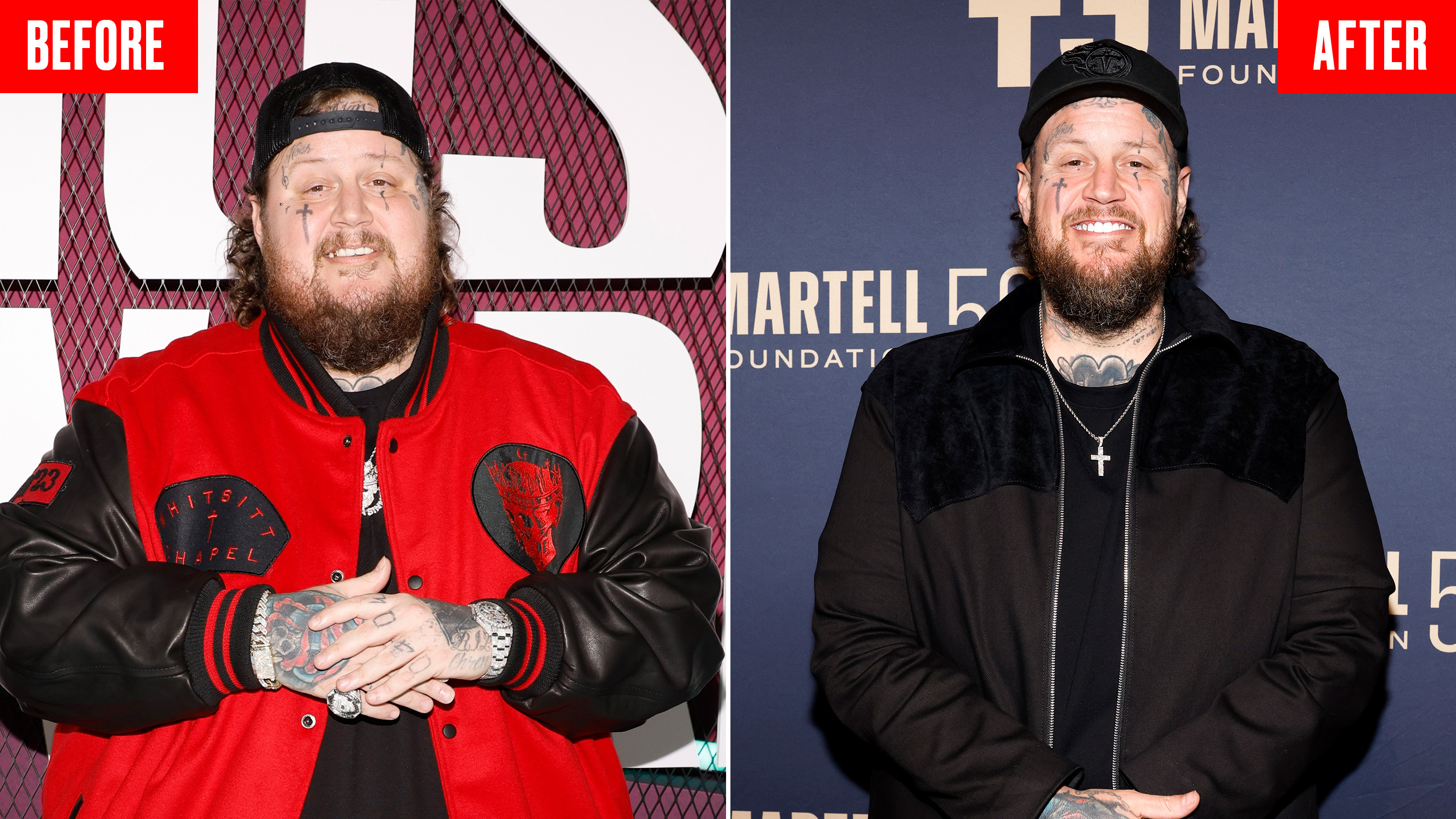 Jelly Roll before and after weight loss transformation